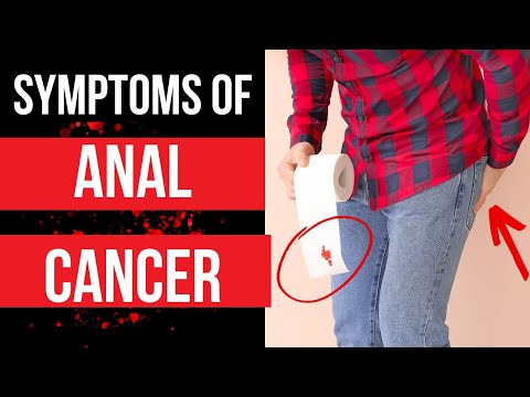 Doctor explains SYMPTOMS OF ANAL CANCER - plus risk factors, diagnosis and treatment