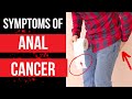 Doctor explains SYMPTOMS OF ANAL CANCER - plus risk factors, diagnosis and treatment