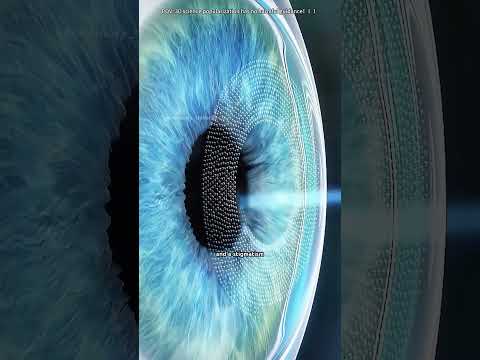 Laser Eye Surgery (3D Animation) #lasik #lasikeyesurgery #lasereyesurgery #lasereyesurgeon