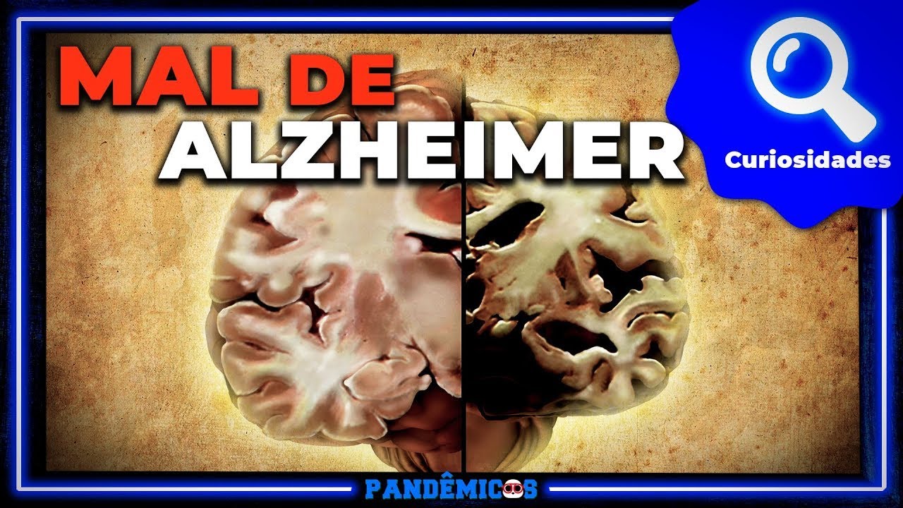 Alzheimer's disease