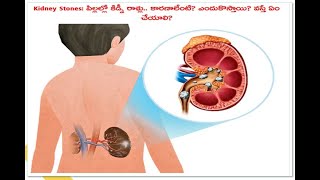 Health Tips || Kidney Stones Reasons