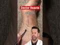 ER Doctor REACTS to "Satisfying" Hair Splinter Removal