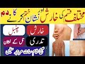 Kharish Ka Dam Kharish Katam Karny Ka Tarika Kharish Katam Karny Ka Amal Irfan Muhammadi
