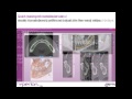 Hyperion X9 NNT 3D Xray Imaging software (Fast ...