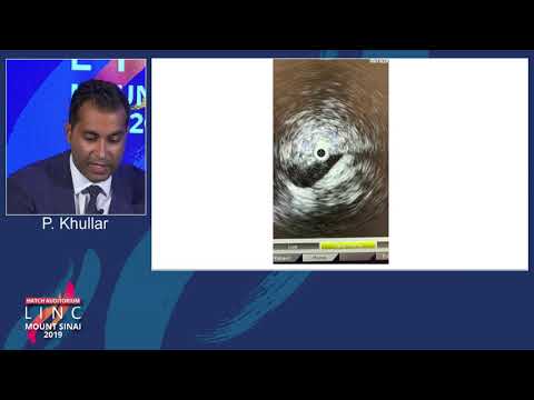 Hatch D1 - Role of Intravascular Imaging and Stent in Lower Extremity Venous Disease - Dr. Khullar
