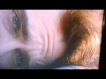 Joaquin Phoenix's Forehead (Original)