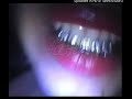 Luci4 Dead N Gone Slowed Reverb To Perfection