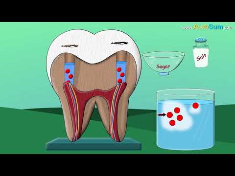 Vì sao răng sâu đau nhức khi ăn đường