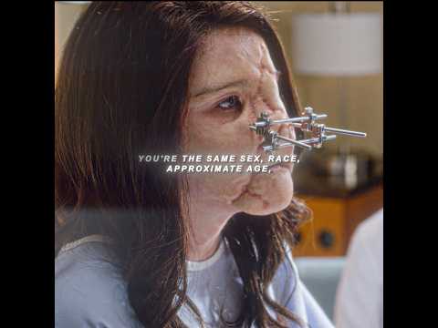 The mother donated her daughter's face to this girl who had suffered severe facial injuries.#edit