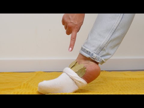 Put some bay leaves in your socks