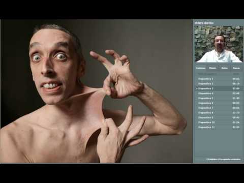 Dr EDUARDO KREMENCHUTZKY - SEMINARIOS DE INTEGRACION - EHLER DANLOS