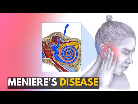Meniere's disease: Everything You Need to Know