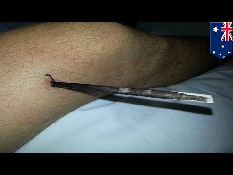 Dlatego trochę tłuszczu dick Wzrost chirurgiczny członkiem sf