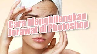 Cara Menghilangkan Jerawat di Adobe Photoshop, Wajah Bersih via Media Foto