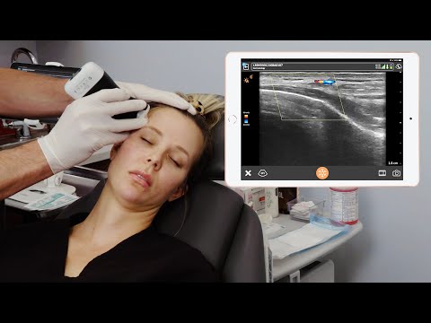 Vascular Mapping for Temporal Injection