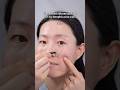 Silicone gel tape working for Atrophic acne scars❓#acnescars #acne #scars