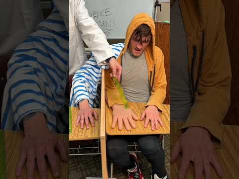 Doctor Experience Him Fake Hand To Real Hand Pain #shorts #cat