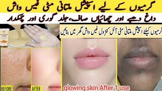 Multani Mitti Face wash | Clear Clean Fair and Glowing skin | Get Rid of Acne Pimples Dark Spots