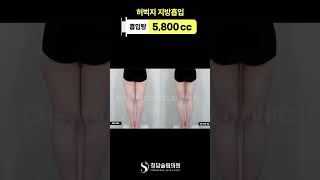 허벅지 안쪽 쓸리는 분 찾아요. 🙋‍♀️