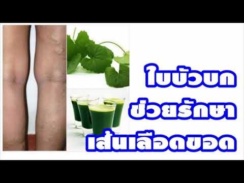 กลากแห้งบนฝ่ามือ วิธีการรักษาโรคสะเก็ดเงินบนหัว