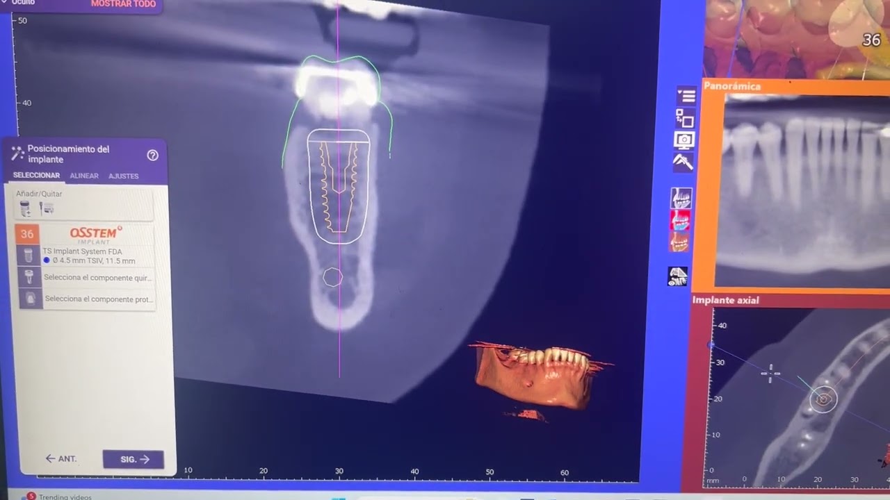 Joel Alejandro Sánchez Zúñiga-8