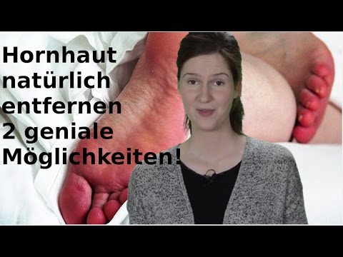 Das Geschwür auf dem Finger neben dem Nagel, wie bei den Kindern zu behandeln Wie die weißen Nägel zu behandeln