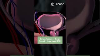 Download lagu 3 Reasons To Check Your Prostate mp3 Download lagu 3 Reasons To Check Your Prostate mp3