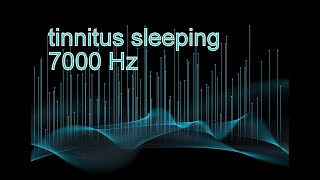 Tinnitus sleeping, vence al tinnitus con terapia de sonido de ruido blanco para acúfenos - HD