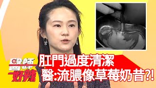 肛門過度清潔，皮膚潰瘍慘壞死？醫師：流膿像草莓奶昔？！【#醫師好辣】20210426 part3 EP1138 吳昭寬 高敏敏