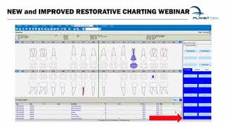 New and Improved Restorative Charting   Denticon Support Webinar