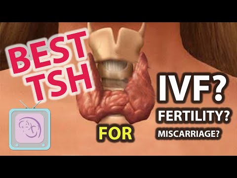 Subclinical hypothyroidism IVF Infertility miscarriage