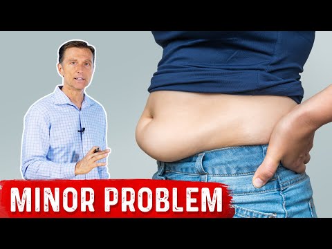 Why Sit Ups Are Bad Exercise to Reduce Belly Fat – Exercise for Belly Fat – Dr Berg