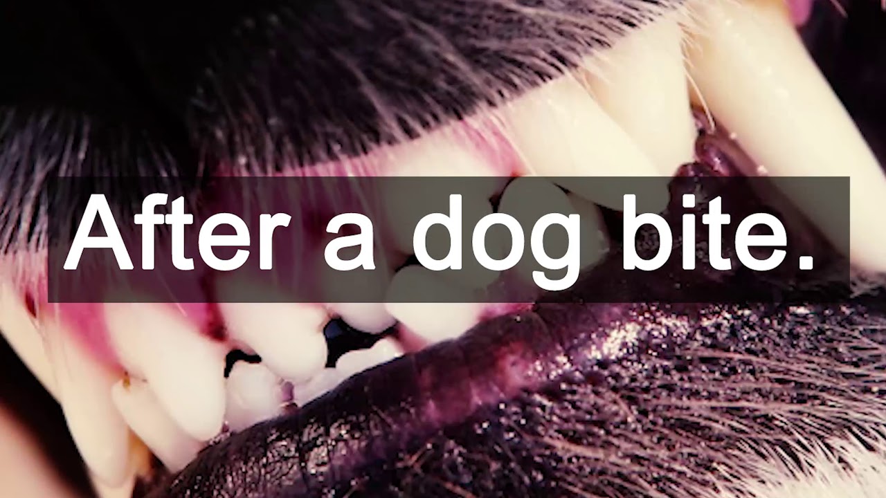 When Should You Call A Personal Injury Attorney?