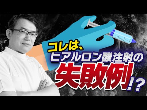 医学科 【全部言います】コレは、ヒアルロン酸注射の失敗例？！