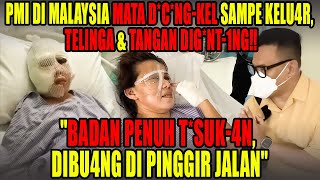 Download lagu PMI DI MALAYSIA DITEMUKAN KRIT1S DI PINGGIR JALAN‼️BADAN PENUH LUK4 T*S*K4N mp3