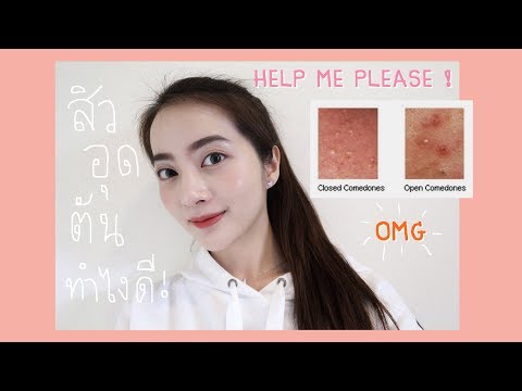ครีมที่เพิ่มขึ้นความคิดเห็นของสมาชิก ความหมายของการขยายขนาดอวัยวะเพศ