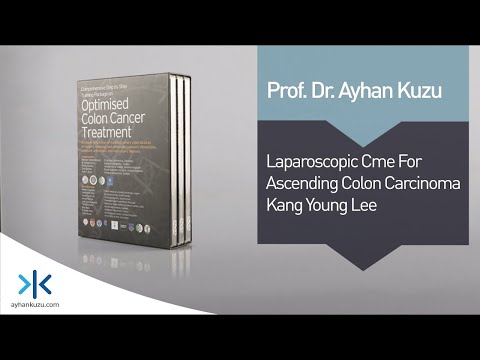 3.1.1. Laparoscopic CME for Ascending Colon Carcinoma - Kang Young Lee