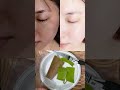 How To Use Aloe Vera To Remove Dark Spots And Sun Tan