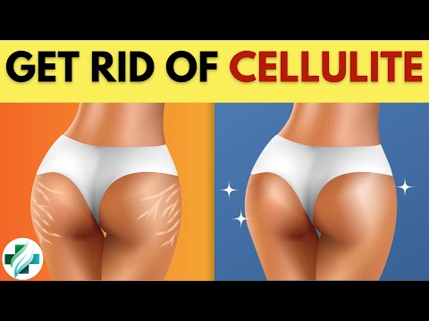 , title : 'Cellulite: Apple Cider Vinegar Does This to Your Skin Cellulite'