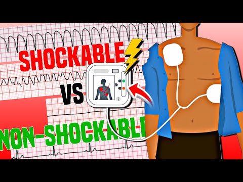 Shockable and Nonshockable ECG Rhythms | ACLS Rhythm Recognition