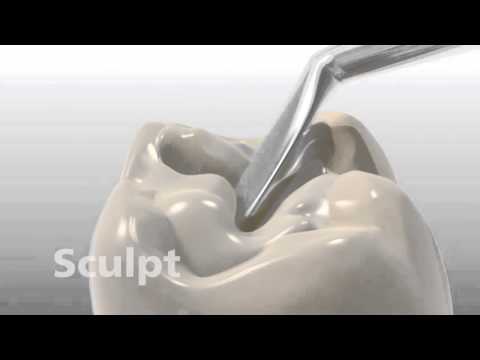 Tetric EvoCeram Bulk Fill Ivoclar Vivadent - ZahnSply