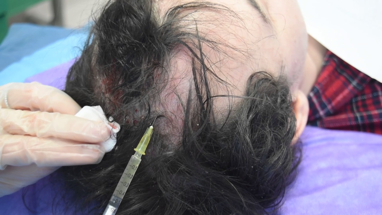 YouTube Video Preview