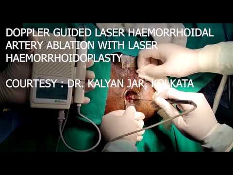 Handheld Doppler For Flow Assessment in Haemorrhoidal Artery