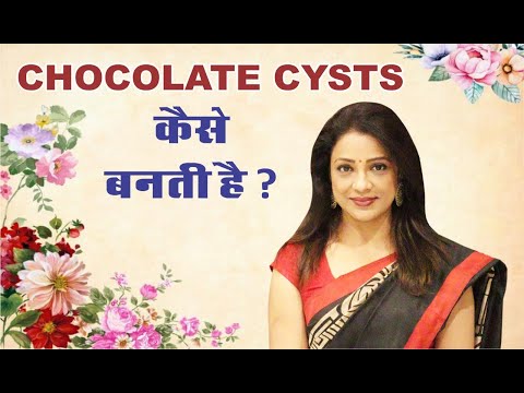 What are chocolate cysts ?