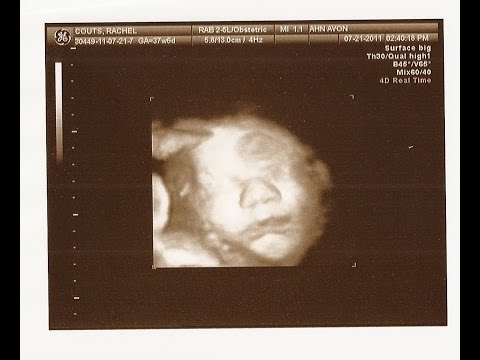 Vlogust Day 9: My Pregnancy with Caleb (2010-2011)