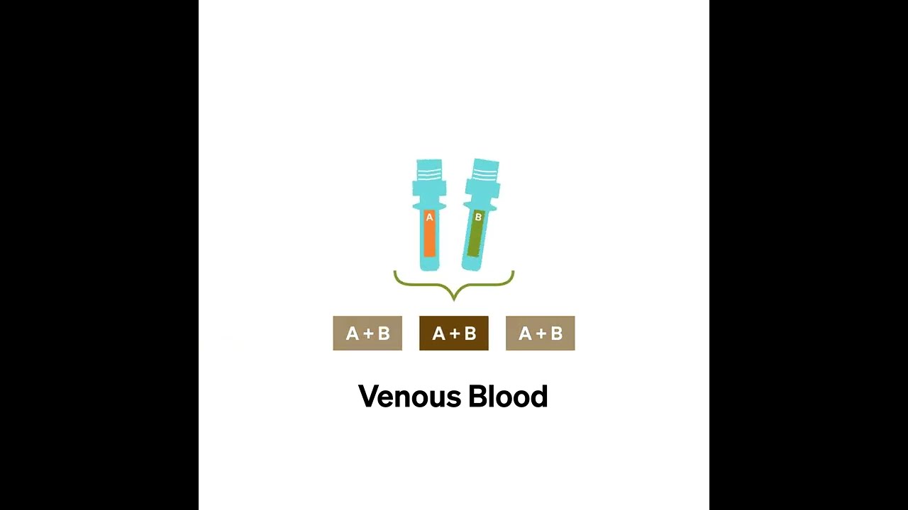 The doping control process: an animation