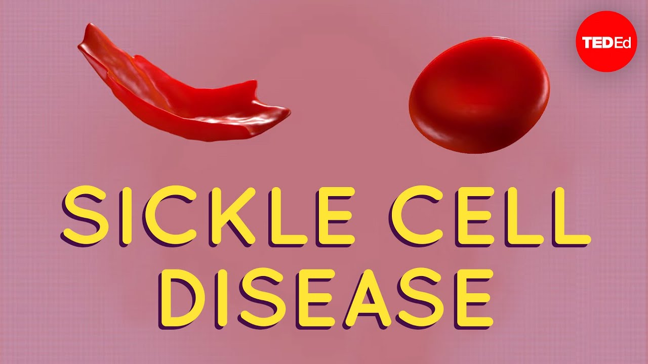 How this disease changes the shape of your cells