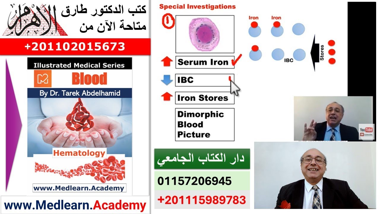 Sideroblastic Anemia   #cme #internal_medicine #medical #medicalstudent  #usmle #محاضرات_باطنة