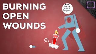 How Does Cauterizing Wounds Work?