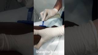 How to laser hair removal? Diode laser #hairremoval #laser #razor #diode